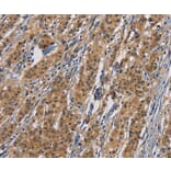 Immunohistochemistry - PIKFYV Antibody from Signalway Antibody (36194) - Antibodies.com