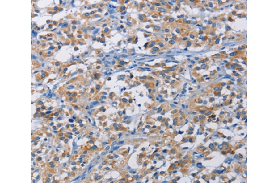 Immunohistochemistry - RICTOR Antibody from Signalway Antibody (36195) - Antibodies.com