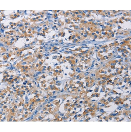 Immunohistochemistry - RICTOR Antibody from Signalway Antibody (36195) - Antibodies.com