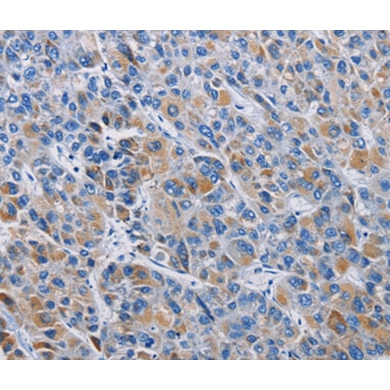 Immunohistochemistry - RICTOR Antibody from Signalway Antibody (36195) - Antibodies.com