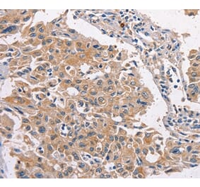 Immunohistochemistry - MAPK15 Antibody from Signalway Antibody (36197) - Antibodies.com