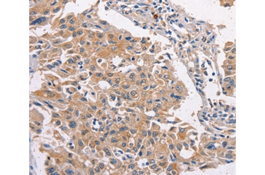 Immunohistochemistry - MAPK15 Antibody from Signalway Antibody (36197) - Antibodies.com