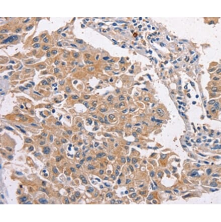 Immunohistochemistry - MAPK15 Antibody from Signalway Antibody (36197) - Antibodies.com