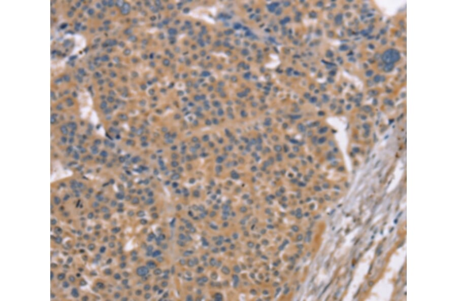 Immunohistochemistry - MAPK15 Antibody from Signalway Antibody (36197) - Antibodies.com