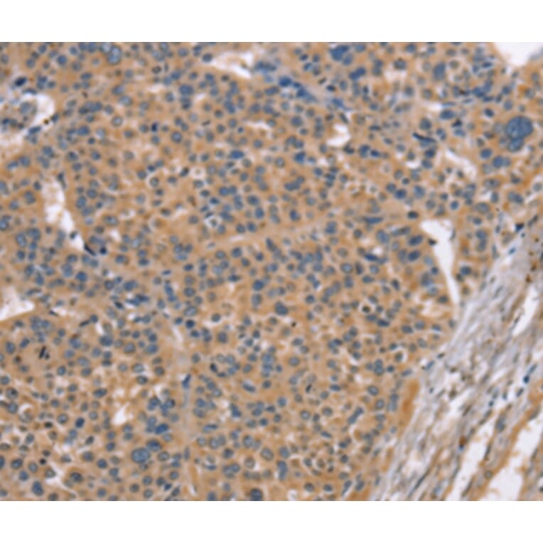 Immunohistochemistry - MAPK15 Antibody from Signalway Antibody (36197) - Antibodies.com