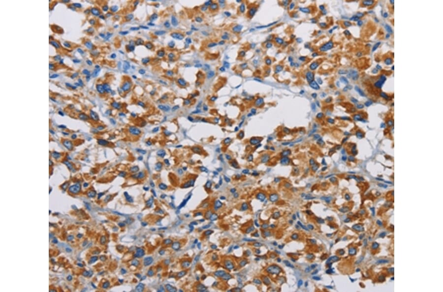 Immunohistochemistry - TSPEAR Antibody from Signalway Antibody (36218) - Antibodies.com