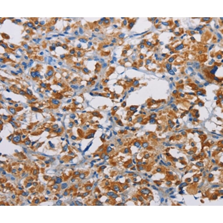 Immunohistochemistry - TSPEAR Antibody from Signalway Antibody (36218) - Antibodies.com