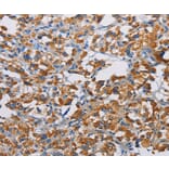 Immunohistochemistry - TSPEAR Antibody from Signalway Antibody (36218) - Antibodies.com