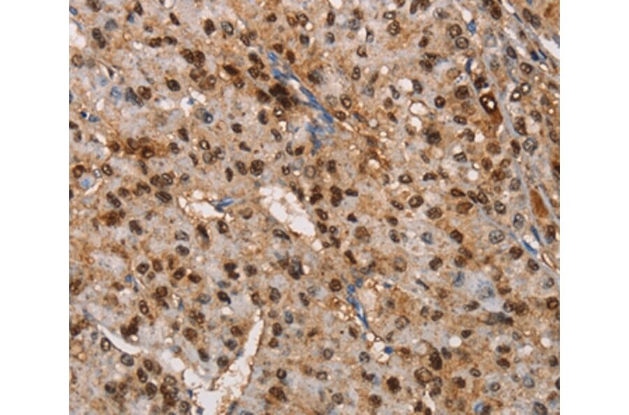 Immunohistochemistry - TSPEAR Antibody from Signalway Antibody (36218) - Antibodies.com