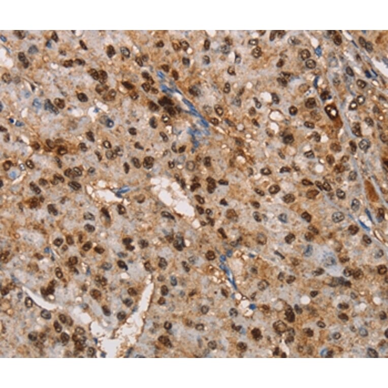 Immunohistochemistry - TSPEAR Antibody from Signalway Antibody (36218) - Antibodies.com