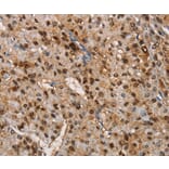 Immunohistochemistry - TSPEAR Antibody from Signalway Antibody (36218) - Antibodies.com