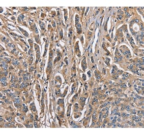 Immunohistochemistry - ABI3BP Antibody from Signalway Antibody (36249) - Antibodies.com