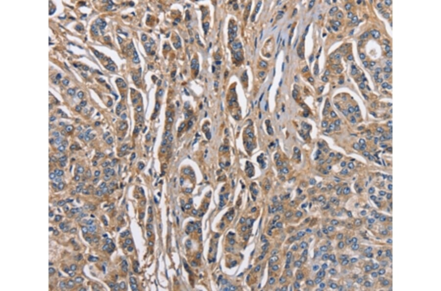 Immunohistochemistry - ABI3BP Antibody from Signalway Antibody (36249) - Antibodies.com