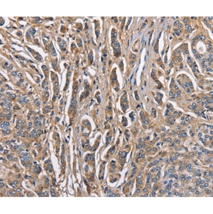 Immunohistochemistry - ABI3BP Antibody from Signalway Antibody (36249) - Antibodies.com