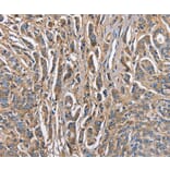 Immunohistochemistry - ABI3BP Antibody from Signalway Antibody (36249) - Antibodies.com