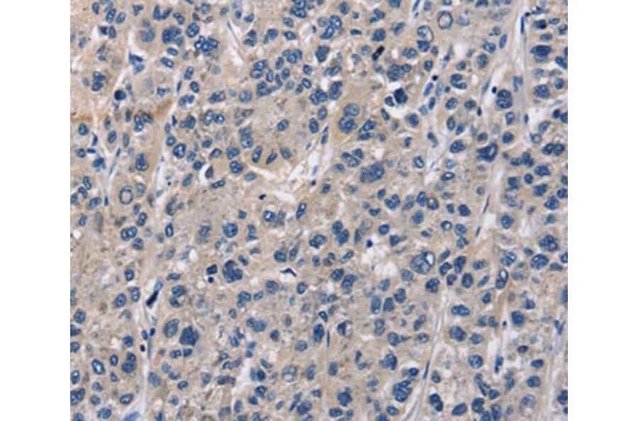 Immunohistochemistry - ABI3BP Antibody from Signalway Antibody (36249) - Antibodies.com