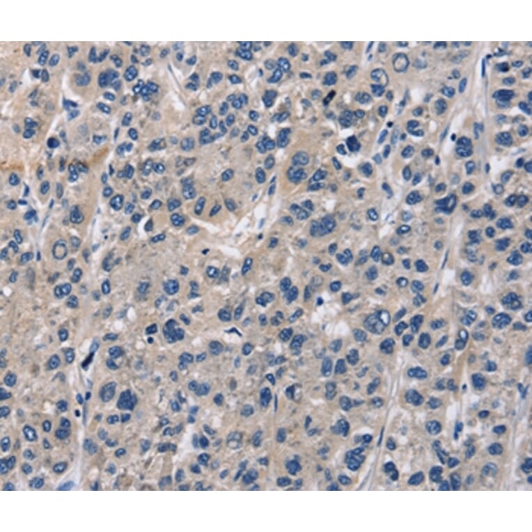 Immunohistochemistry - ABI3BP Antibody from Signalway Antibody (36249) - Antibodies.com