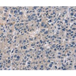 Immunohistochemistry - ABI3BP Antibody from Signalway Antibody (36249) - Antibodies.com