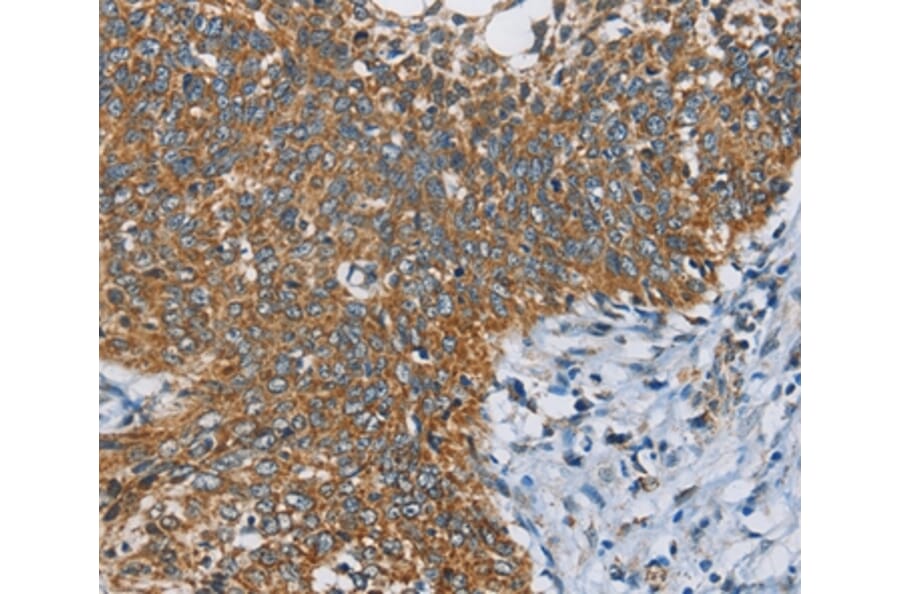 Immunohistochemistry - ANKHD1 Antibody from Signalway Antibody (36259) - Antibodies.com