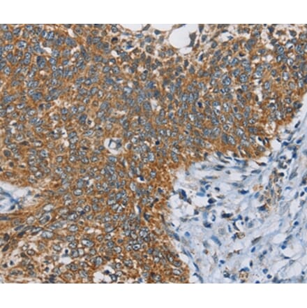 Immunohistochemistry - ANKHD1 Antibody from Signalway Antibody (36259) - Antibodies.com