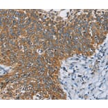 Immunohistochemistry - ANKHD1 Antibody from Signalway Antibody (36259) - Antibodies.com