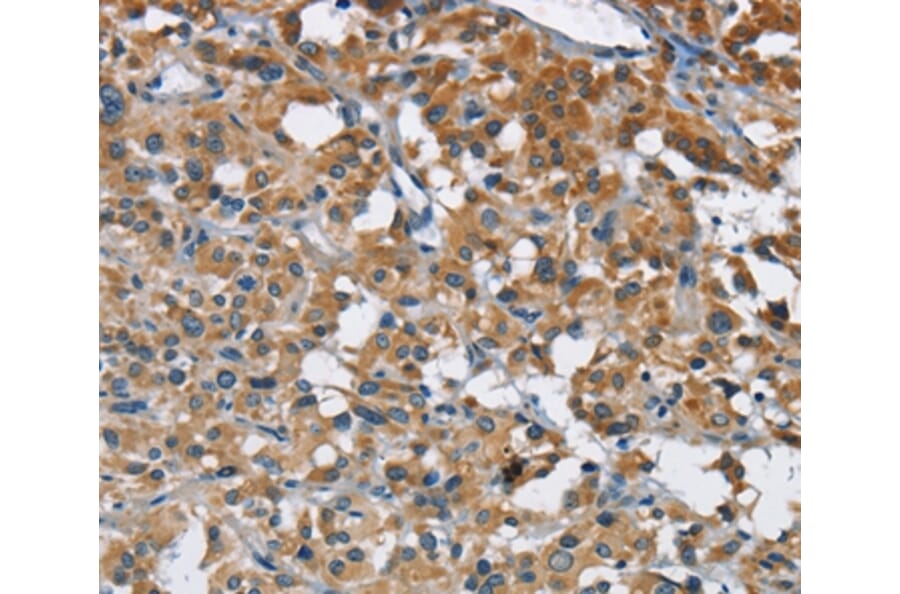 Immunohistochemistry - ANKHD1 Antibody from Signalway Antibody (36259) - Antibodies.com
