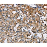 Immunohistochemistry - ANKHD1 Antibody from Signalway Antibody (36259) - Antibodies.com
