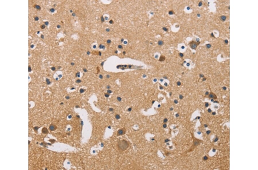 Immunohistochemistry - ATP2C1 Antibody from Signalway Antibody (36269) - Antibodies.com