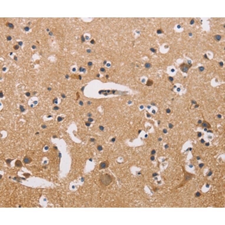 Immunohistochemistry - ATP2C1 Antibody from Signalway Antibody (36269) - Antibodies.com