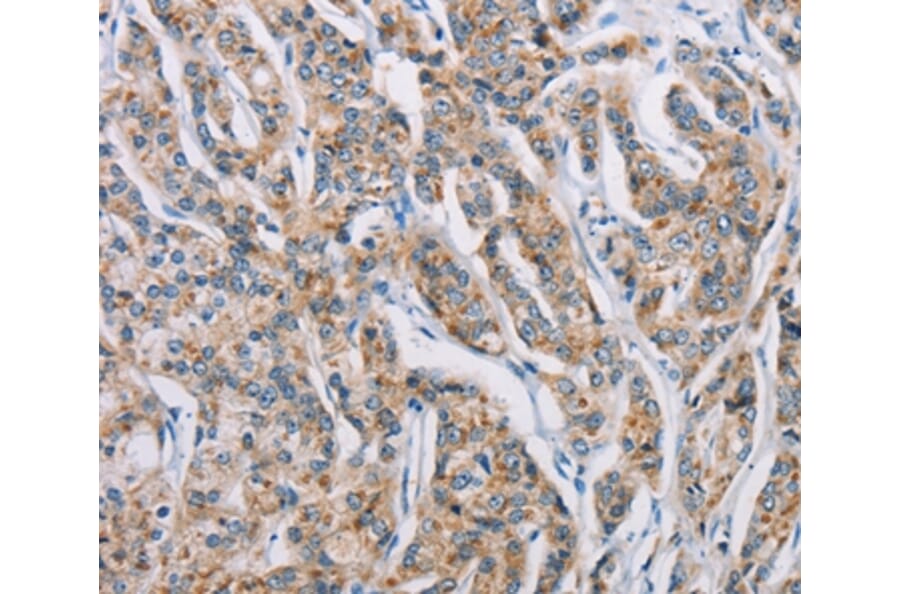 Immunohistochemistry - ATP2C1 Antibody from Signalway Antibody (36269) - Antibodies.com