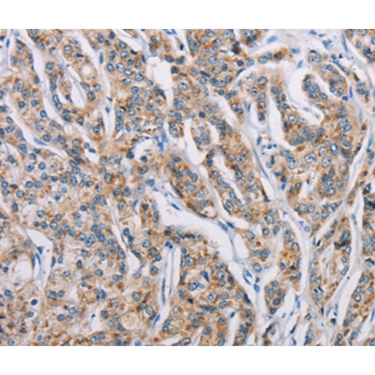 Immunohistochemistry - ATP2C1 Antibody from Signalway Antibody (36269) - Antibodies.com