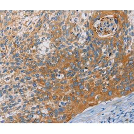 Immunohistochemistry - KCNMA1 Antibody from Signalway Antibody (36283) - Antibodies.com