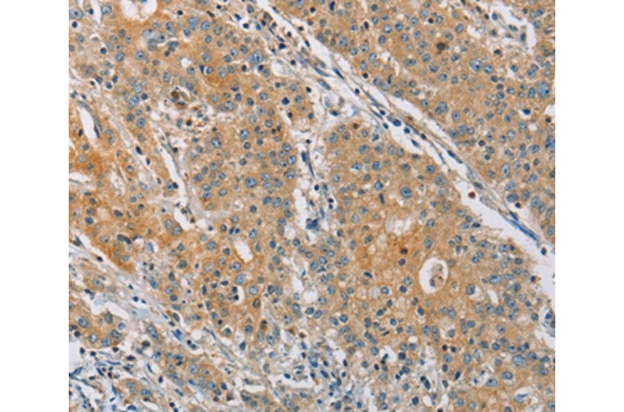 Immunohistochemistry - KCNMA1 Antibody from Signalway Antibody (36283) - Antibodies.com