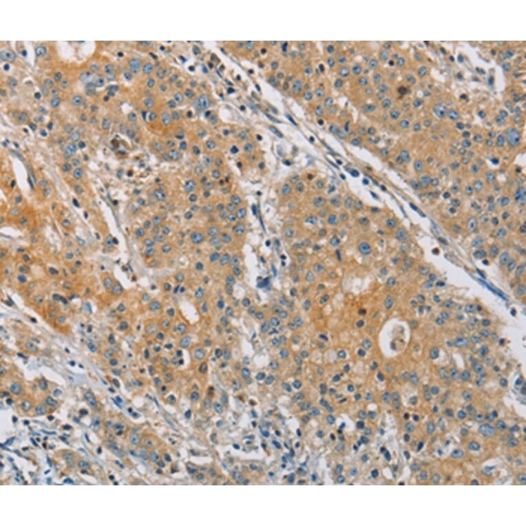 Immunohistochemistry - KCNMA1 Antibody from Signalway Antibody (36283) - Antibodies.com