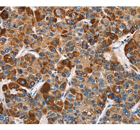 Immunohistochemistry - SLAMF8 Antibody from Signalway Antibody (36284) - Antibodies.com