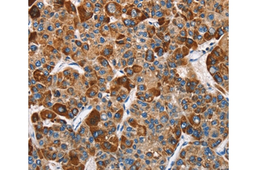 Immunohistochemistry - SLAMF8 Antibody from Signalway Antibody (36284) - Antibodies.com