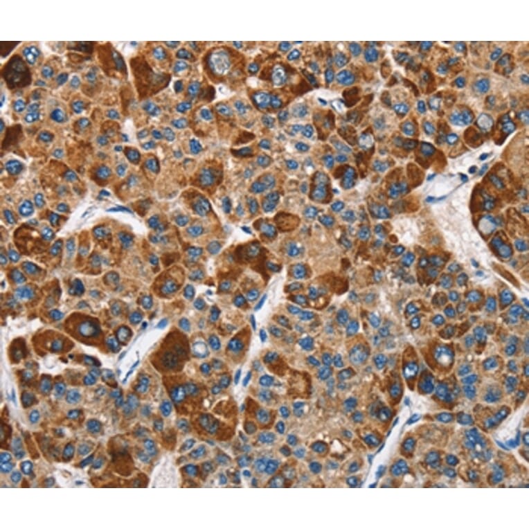 Immunohistochemistry - SLAMF8 Antibody from Signalway Antibody (36284) - Antibodies.com
