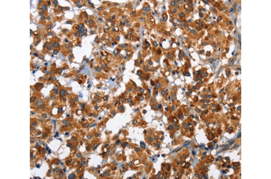 Immunohistochemistry - SLAMF8 Antibody from Signalway Antibody (36284) - Antibodies.com