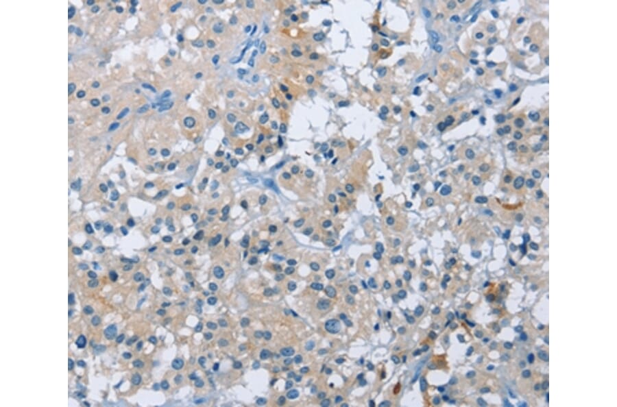 Immunohistochemistry - BTN2A2 Antibody from Signalway Antibody (36293) - Antibodies.com