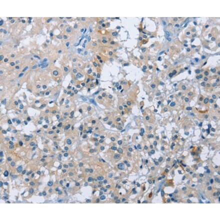 Immunohistochemistry - BTN2A2 Antibody from Signalway Antibody (36293) - Antibodies.com