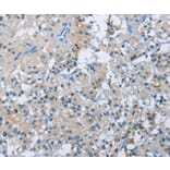 Immunohistochemistry - BTN2A2 Antibody from Signalway Antibody (36293) - Antibodies.com