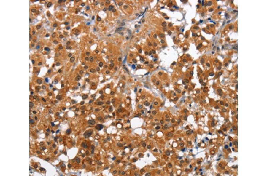 Immunohistochemistry - CAMK1D Antibody from Signalway Antibody (36303) - Antibodies.com