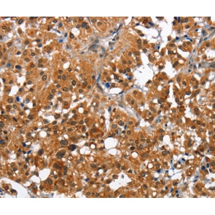 Immunohistochemistry - CAMK1D Antibody from Signalway Antibody (36303) - Antibodies.com