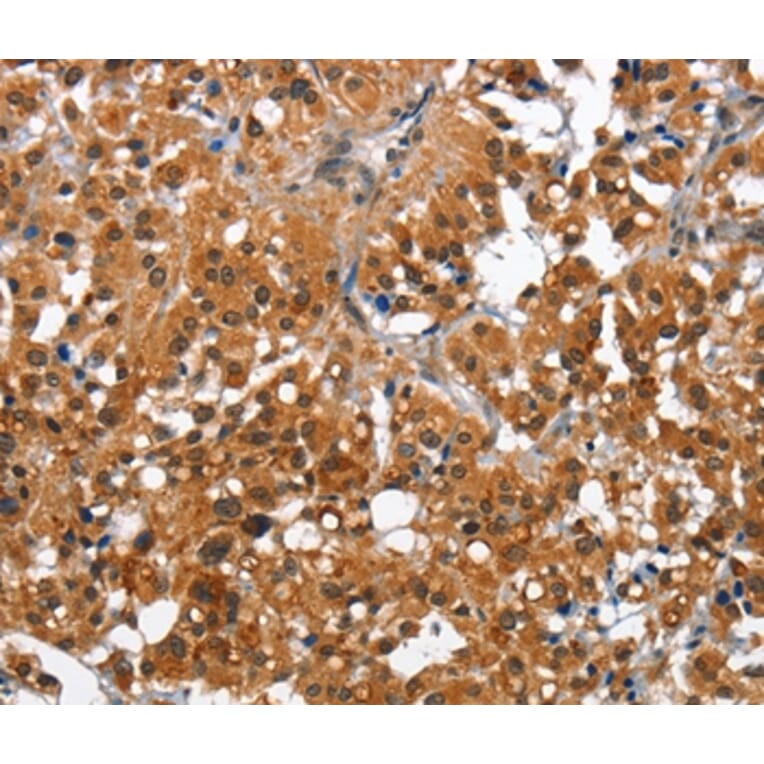 Immunohistochemistry - CAMK1D Antibody from Signalway Antibody (36303) - Antibodies.com