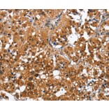 Immunohistochemistry - CAMK1D Antibody from Signalway Antibody (36303) - Antibodies.com