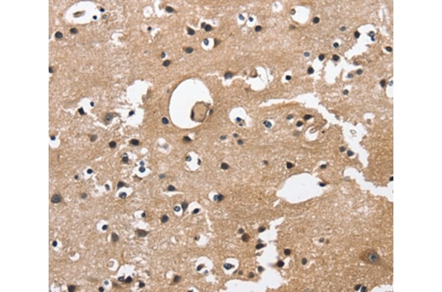 Immunohistochemistry - CAMK1D Antibody from Signalway Antibody (36303) - Antibodies.com