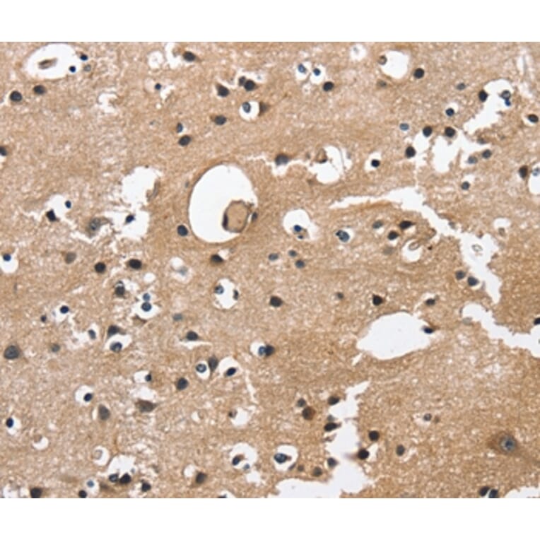 Immunohistochemistry - CAMK1D Antibody from Signalway Antibody (36303) - Antibodies.com