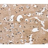 Immunohistochemistry - CAMK1D Antibody from Signalway Antibody (36303) - Antibodies.com
