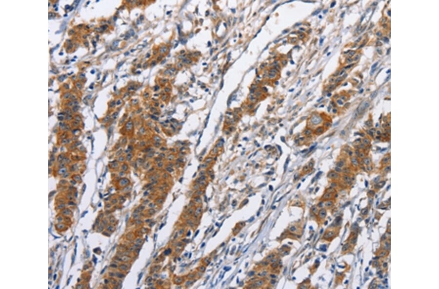 Immunohistochemistry - NCAPD3 Antibody from Signalway Antibody (36306) - Antibodies.com