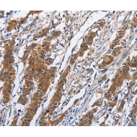 Immunohistochemistry - NCAPD3 Antibody from Signalway Antibody (36306) - Antibodies.com